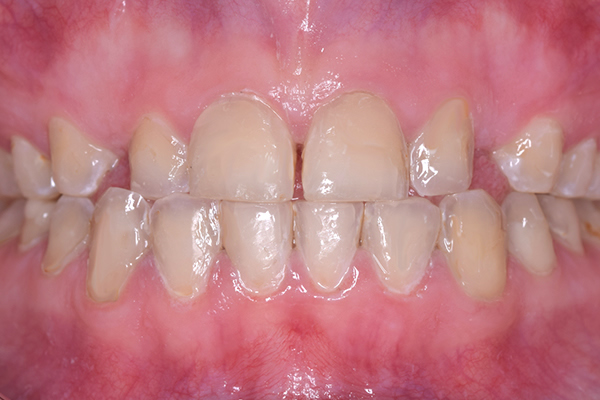 Dental Hygienist Leicester | Trusted Oral Hygiene Experts
