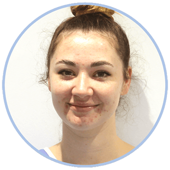 Ashton Gomersall Trainee Dental Nurse at Forest House Dental